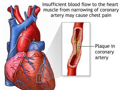 Angina- The Updated World